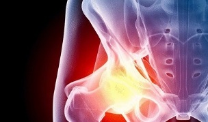 causes of the development of hip arthrosis