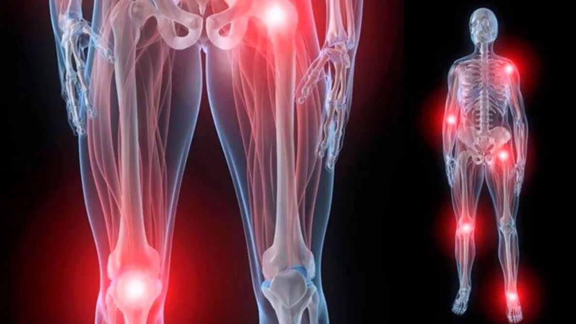joint pain throughout the body