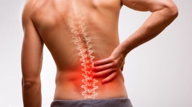 Signs and symptoms of osteochondrosis of the lumbar spine