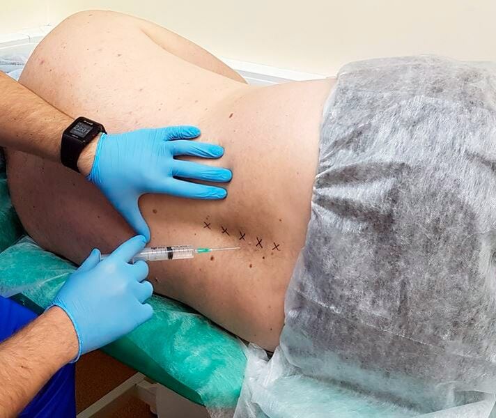 medicinal blockades for the back